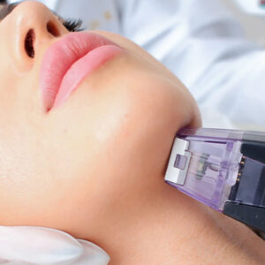 هل تعمل الإبرة الذهبية؟